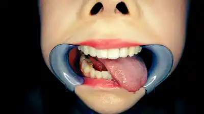 キャプチャ画像18