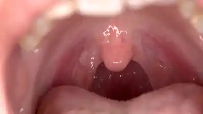 キャプチャ画像13